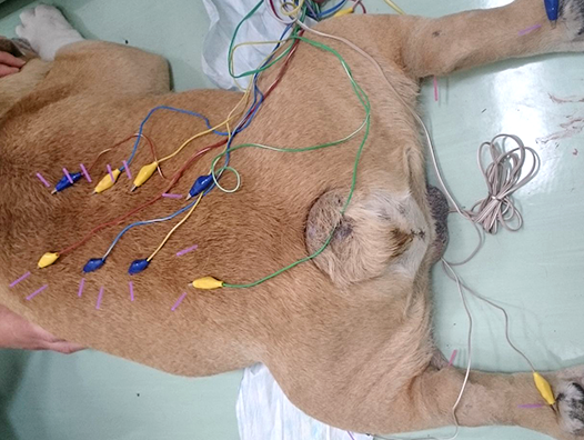 胸腰部椎間板ヘルニア 症例動画(5)